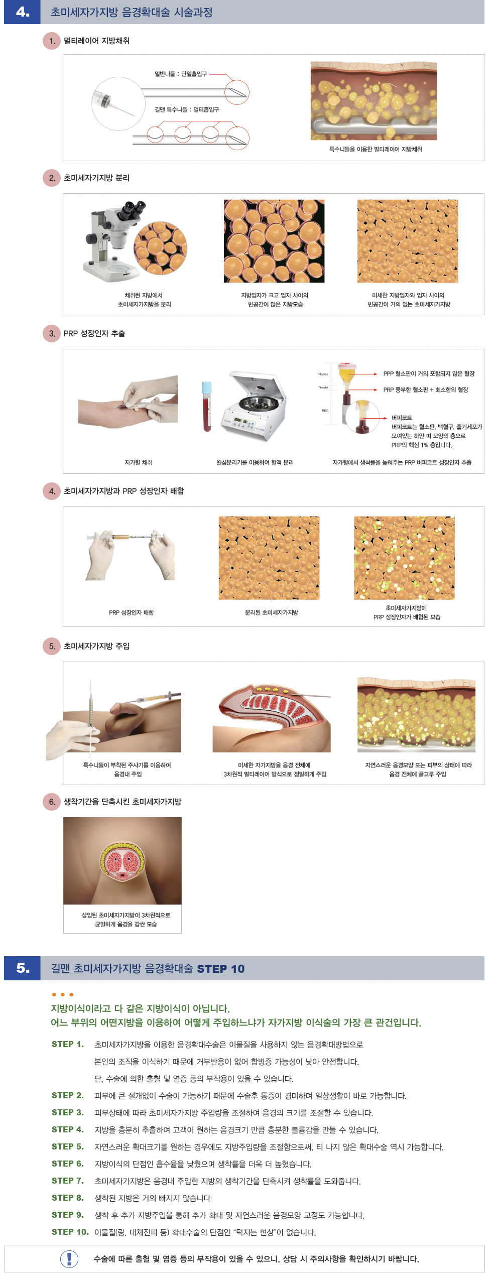 초미세자가지방확대