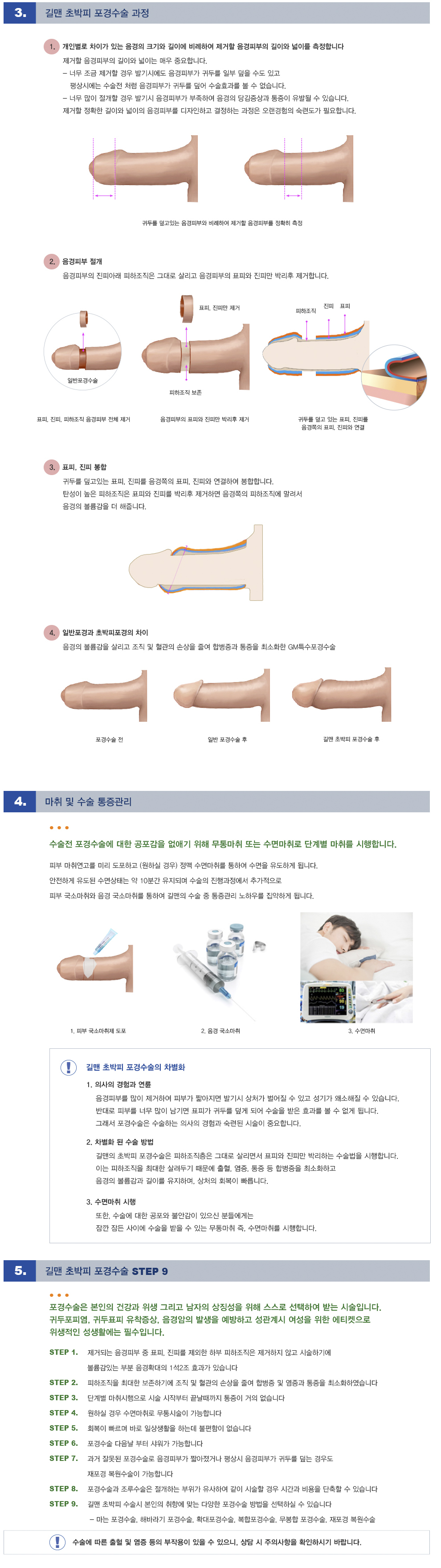 길맨 초박피 포경수술