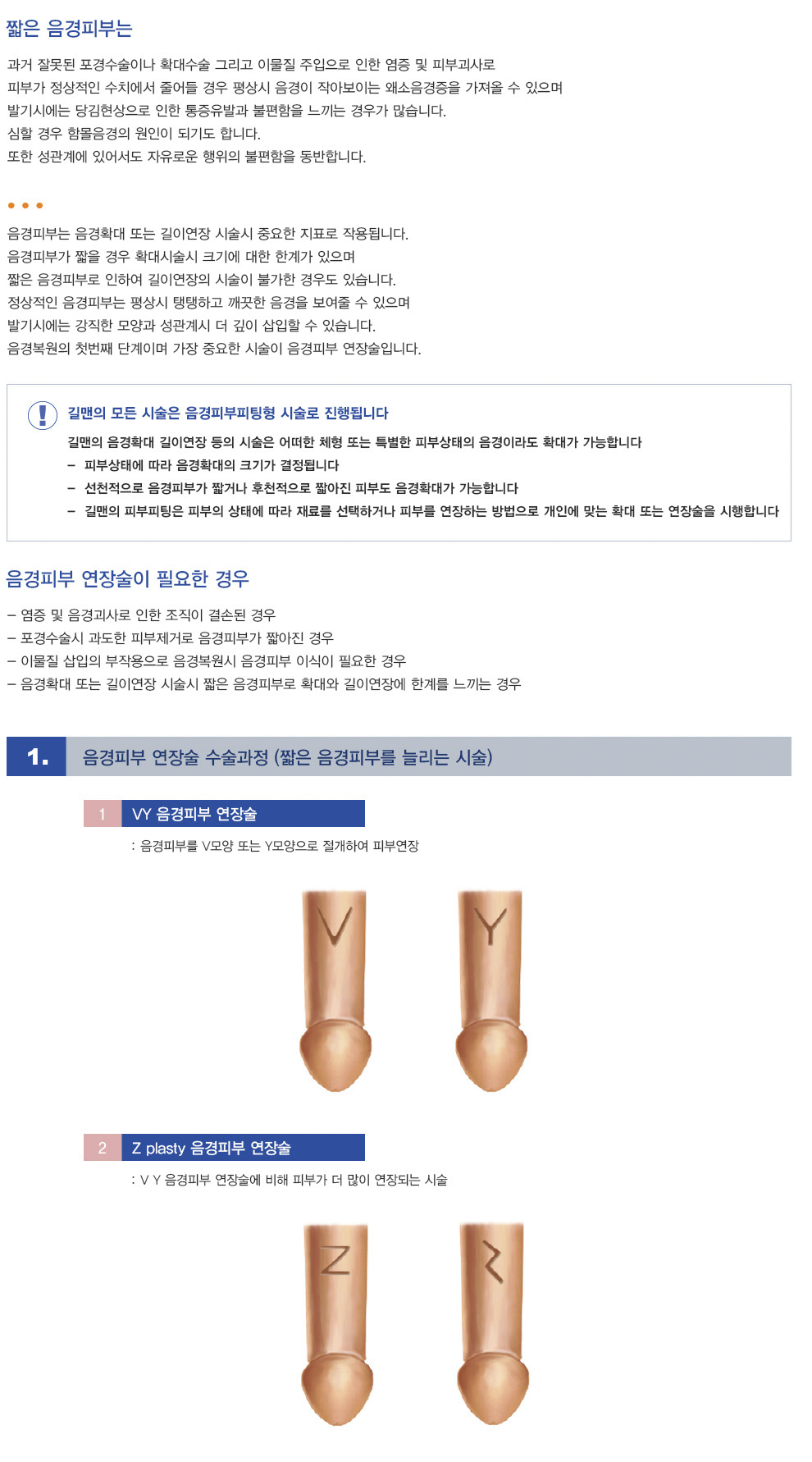 음경피부 연장술